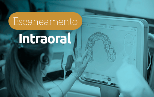 escaneamento intraoral