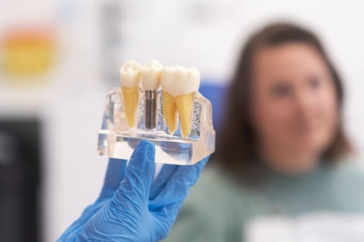 Dentista mostra o mockup de um implante dentário para paciente.